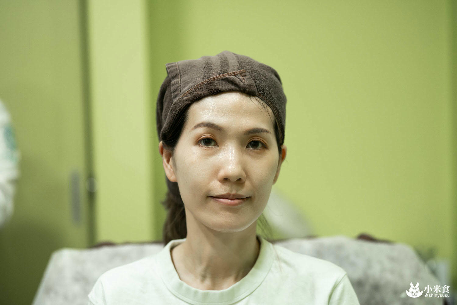 想要改善黑眼圈,醫美推薦-双美膠原蛋白植入劑(熊貓針)心得分享|高雄仲夏醫美診所 - 第18張圖