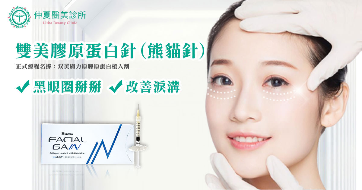 想要改善黑眼圈,醫美推薦-双美膠原蛋白植入劑(熊貓針)心得分享|高雄仲夏醫美診所 - 第9張圖